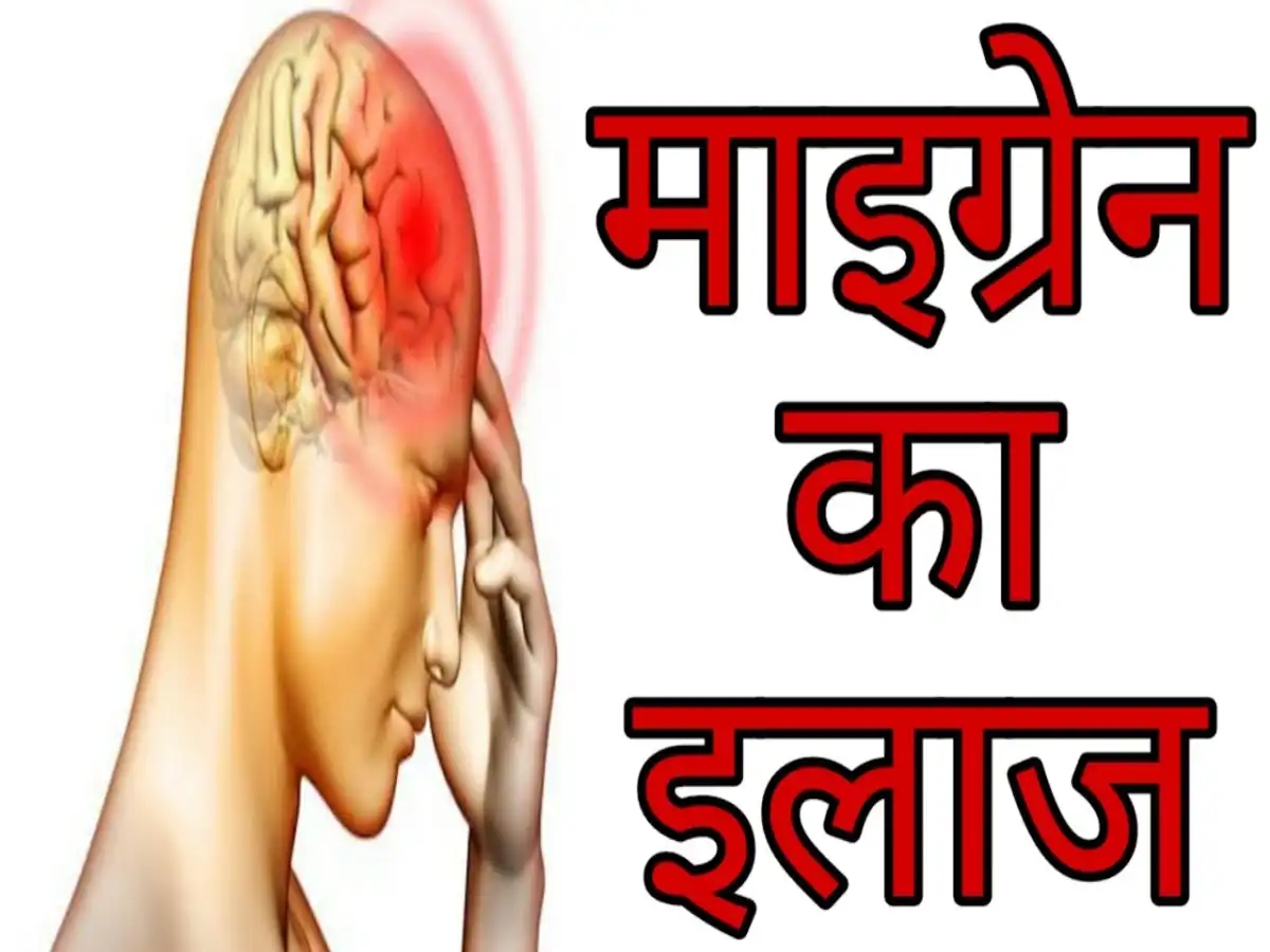 Migraine : माइग्रेन का रामबाण इलाज