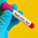 Nipah virus confirmed in a 14-year-old boy in Kerala, Health Minister calls high-level meeting