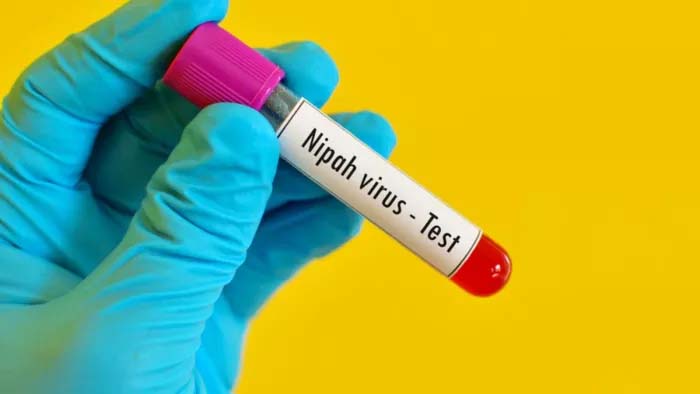 Nipah virus confirmed in a 14-year-old boy in Kerala, Health Minister calls high-level meeting